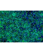 HiPSC-Derived Neural Stem Cells (HiPSC-NSC) - Immunostaining for Nestin, 200x
