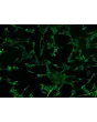 Human Iris Fibroblasts (HIrF)- Immunostaining for FN, 200X
