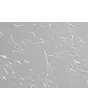 Human Iris Fibroblasts (HIrF) - Relief Contrast, 200x
