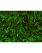 Human Leptomeningeal Pericytes (HLP) – Immunostaining for PDGF Receptor-Beta, 200x
