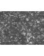 Human Leydig Cells (HLC)-Phase contrast, 100x..
