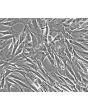 Human Lymphatic Fibroblasts (HLF) - Relief contrast