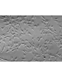 Human Meningeal Cells (HMC) - Relief contrast, 200x.
