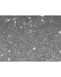 Human Mesenteric Fibroblasts (HMeF)-Phase Contrast, 100x
