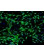 Human Myometrial Microvascular Endothelial Cells (HMMEC)-Relief Contrast