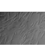 Human Myometrial Smooth Muscle Cells (HMSMC)-Relief contrast, 400x.
