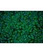 Human Nucleus Pulposus Cells (HNPC) - Immunostaining for Vimentin, 200x.
