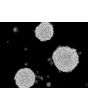 Human Oligodendrocyte Precursor Cell-oligospheres (HOPC-os) - Phase contrast
