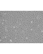 Human Ovarian Microvascular Endothelial Cells (HOMEC) - Phase contrast, 100x.
