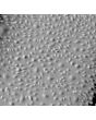 Human Ovarian Microvascular Endothelial Cells (HOMEC) - Phase contrast