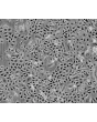 Human Ovarian Surface Epithelial Cells (HOSEpiC) - Phase contrast, 100x.
