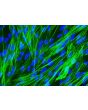 Human Pulmonary Artery Smooth Muscle Cells [HPASMC] - Immunostaining for &alpha;-SMA