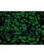 Human Pulmonary Microvascular Endothelial Cells (HPMEC) - Immunostaining for Factor VIII