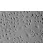 Human Renal Glomerular Endothelial Cells (HRGEC) - Relief contrast, 200x.
