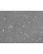 Human Renal Glomerular Endothelial Cells (HRGEC) - Relief contrast