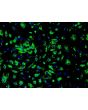 Human Renal Glomerular Endothelial Cells (HRGEC) - Immunostaining for Factor VIII
