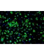 Human Renal Glomerular Endothelial Cells (HRGEC) - Immunostaining for vWF, 200x.
