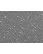 Human Scalp Fibroblasts-fetal (HScF-f) - Relief contrast, 200x.
