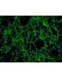 Human Seminal Vesicle Fibroblasts (HSVF) - Immunostaining for Fibronectin