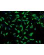 Human Seminal Vesicle Microvascular Endothelial Cells (HSVMEC) - Immunostaining for Factor VIII