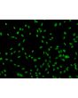 Human Sertoli Cells (HSerC)-Immunostaining for SOX-9, 200x.
