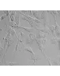 Human Skeletal Muscle Satellite Cells (HSkMSC) - Relief contrast, 400x.

