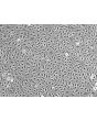 Human Splenic Endothelial Cells (HSEC) - Relief contrast