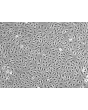 Human Splenic Endothelial Cells (HSEC) - Phase contrast, 100x.
