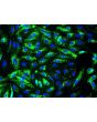 Human Splenic Endothelial Cells (HSEC) - Immunostaining for Factor VIII