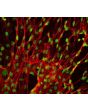 Human Splenic Fibroblasts (HSF) - Immunostaining for Fibronectin