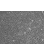 Human Tonsil Endothelial Cells (HTEC) – Phase Contrast, 100x