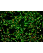 Human Tracheal Fibroblasts (HTrF) – Immunostaining for FN, 200x
