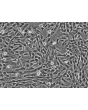Human Umbilical Mesenchymal Stem Cells (HUMSC) - Phase contrast, 100x.
