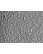 Human Umbilical Mesenchymal Stem Cells (HUMSC) - Relief contrast, 100x.
