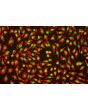 Human Umbilical Vein Endothelial Cells (HUVEC) - Immunofluorescence for Factor VIII (Sigma-Aldrich Cat.#F3520)