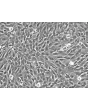 Human Vertebral Mesenchymal Stem Cells (HVMSC) - Phase contrast, 200x.
