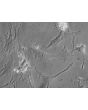 Mouse Cardiac Myocytes (MCM) - Relief contrast, 400x.
