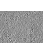 Mouse Cerebellar Granule Cells (MGC) - Relief contrast, 400x.
