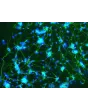 Mouse Cerebellar Granule Cells (MGC) - Immunostaining for β-Tubulin III, 200x.
