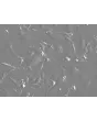 Mouse Dermal Fibroblasts (MDF)- Relief Contrast, 200x