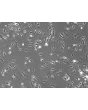 Mouse Dermal Fibroblasts (MDF)- Phase Contrast, 100x