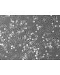 Mouse Hepatic Mesothelial Cells (MHMeC) - Phase Contrast, 100x