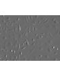 Mouse Hepatic Mesothelial Cells (MHMeC) - Relief Contrast, 200x