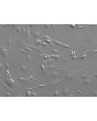 Mouse Hepatic Stellate Cells (MHSteC) - Phase contrast