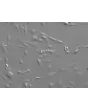 Mouse Hepatic Stellate Cells (MHSteC) - Relief contrast 200x
