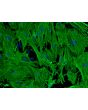 Mouse Hepatic Stellate Cells (MHSteC), Immunostaining for  αSMA, 200X