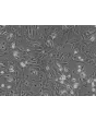 Mouse Hepatic Stellate Cells (MHSteC) - Phase contrast, 100x.
