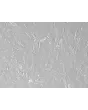 Mouse Lymphatic Fibroblasts (MLF) – Relief Contrast, 200x

