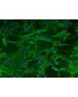Mouse Lymphatic Fibroblasts (MLF) – Immunostaining for Fibronectin, 200x

