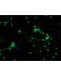 Mouse Neurons-hippocampal (MN-h) - Relief contrast